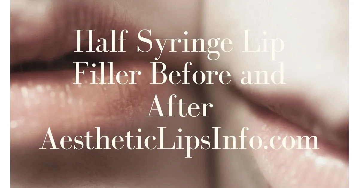 Half Syringe Lip Filler Before and After AestheticLipsInfo.com